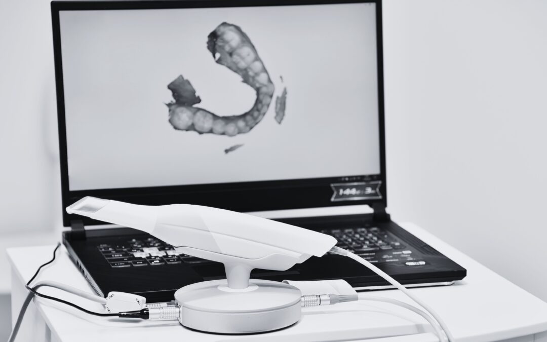Escáner intraoral 3D: la tecnología que mejora tu diagnóstico dental