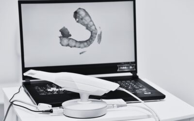 Escáner intraoral 3D: la tecnología que mejora tu diagnóstico dental