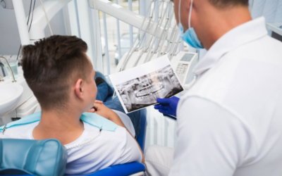 ¿Por qué son tan importantes las revisiones dentales periódicas?